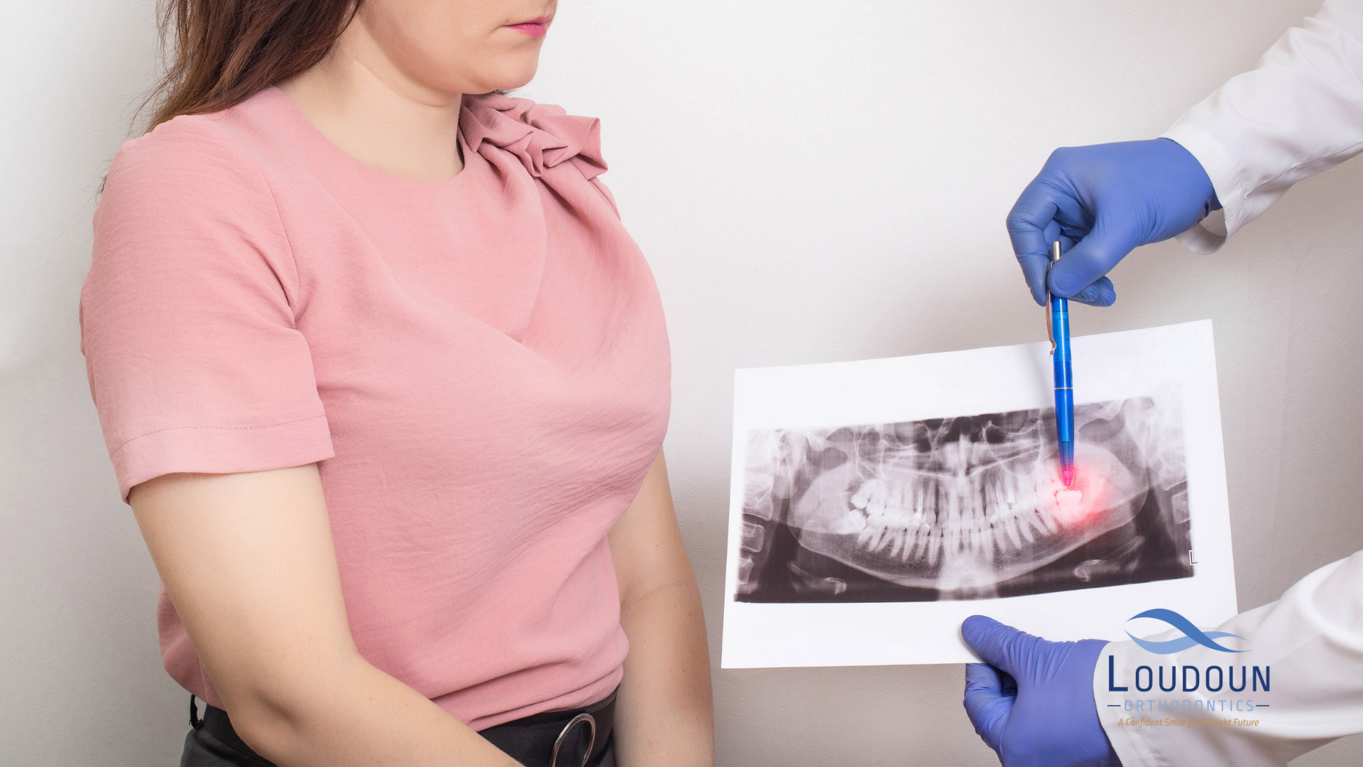 Impacted Wisdom Tooth X-ray