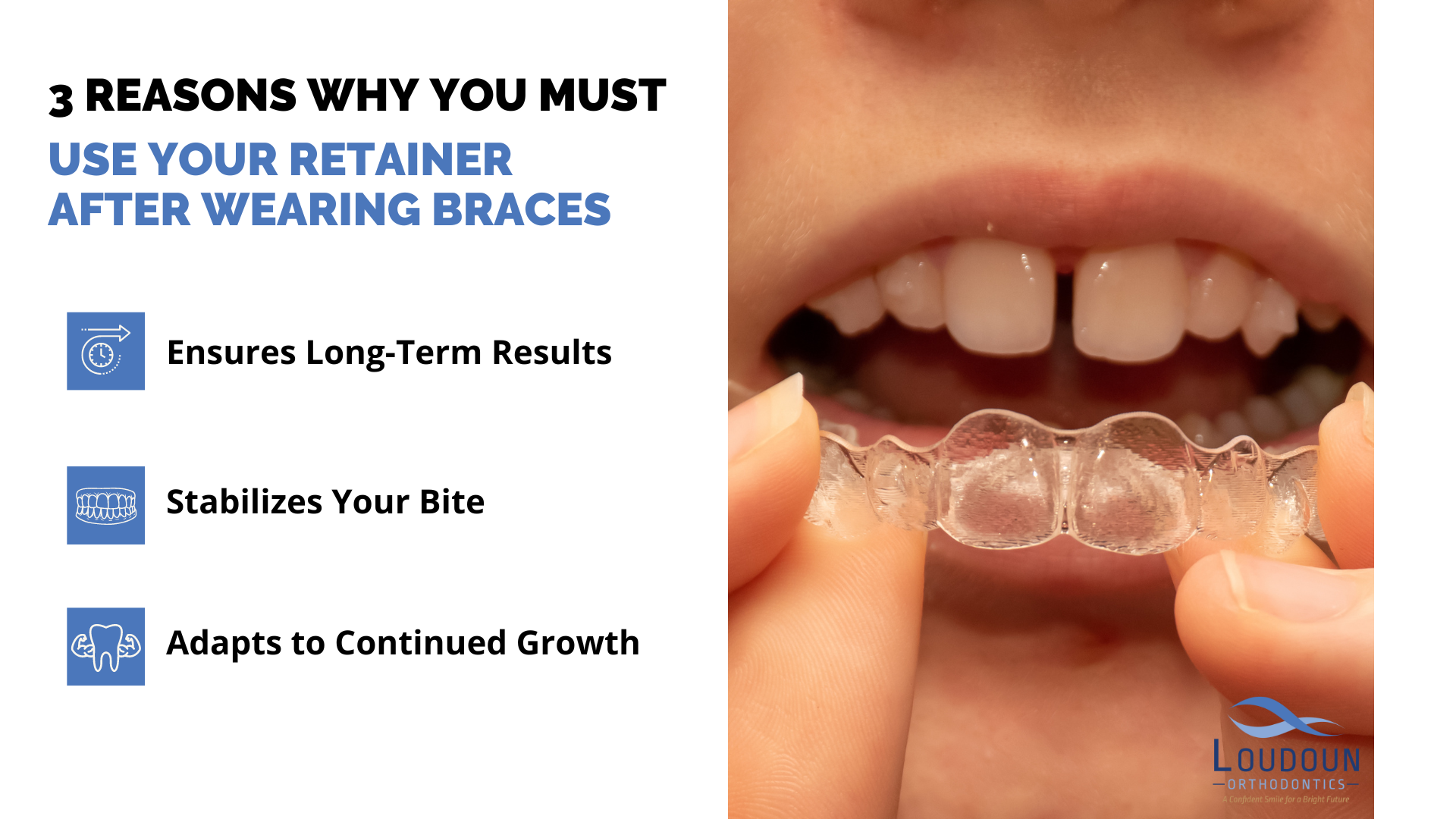 Can Braces Cause Gaps in My Teeth?