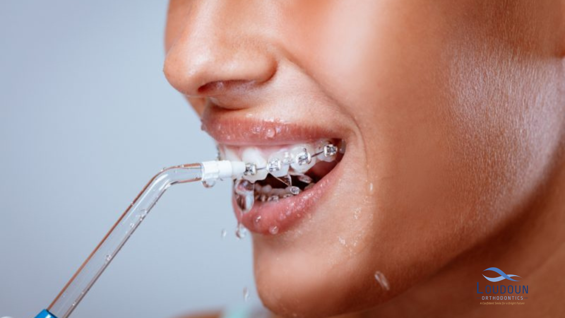 Benefits of Using a Water Flosser,Dentists Recommend Water Flossing,How Long Do Water Flossers Last,Teeth Straightening,Teeth Straightening Services,Tips and Techniques for the Best Water Flossing Results,Traditional Flossing,Water Flosser,Water Flosser vs. Traditional Flossing,Water Flossing,Water Flossing Help Prevent Gum Disease,water