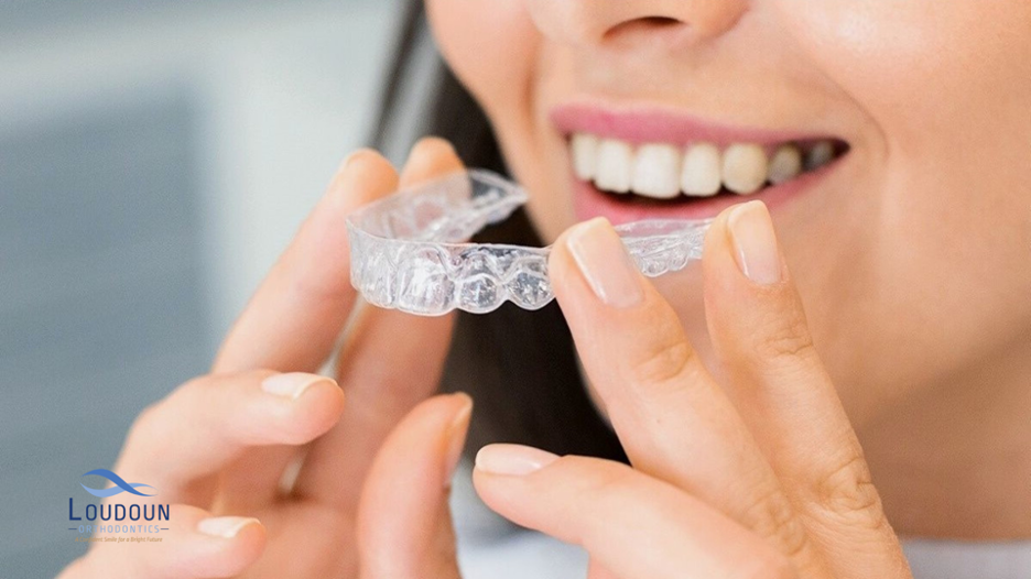 invisalign,invisalign cause gum recession,gum recession,is gum recession reversable,invisalign after care