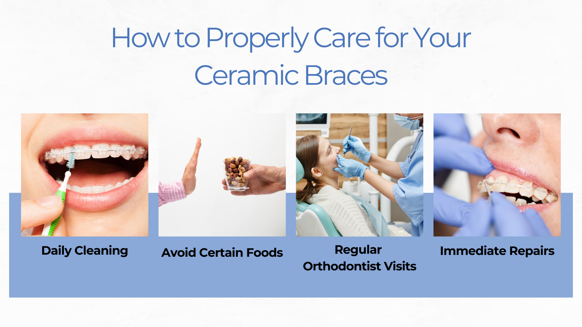 How to Properly Care for Your Ceramic Braces