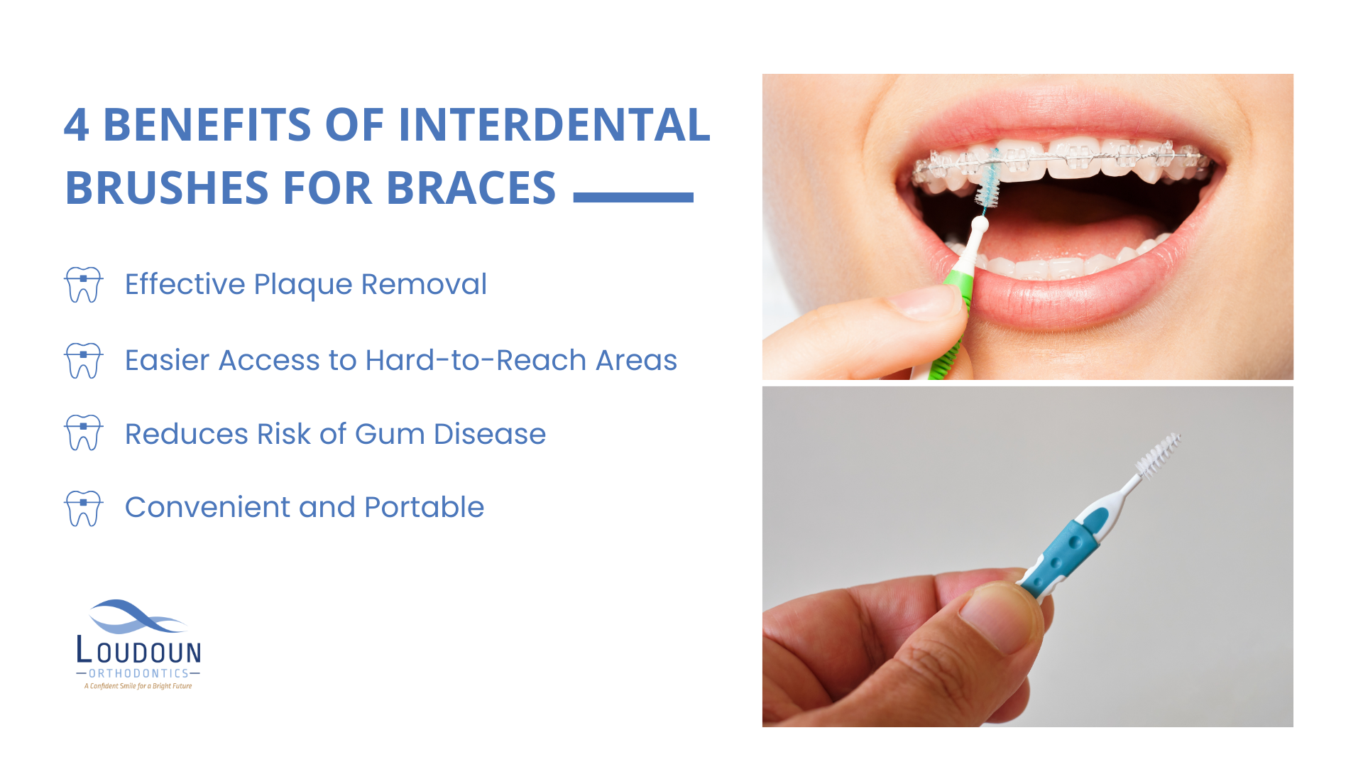 4 Benefits of Interdental Brushes for Braces