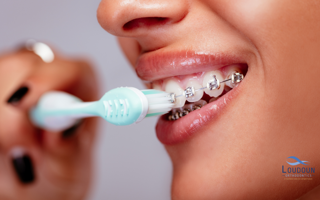 Smile Bright: 7 Essential Tips for Brushing with Braces