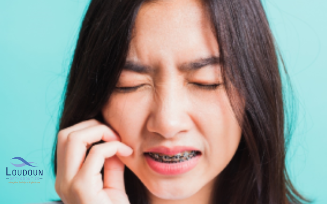 Canker Sores from Braces: How to Alleviate Pain and Speed Up Healing