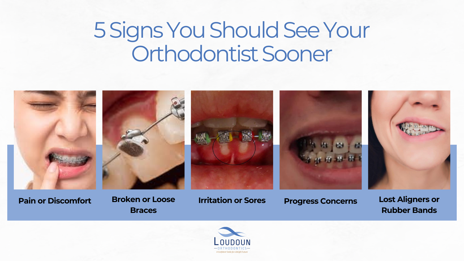 5 Signs You Should See Your Orthodontist Sooner