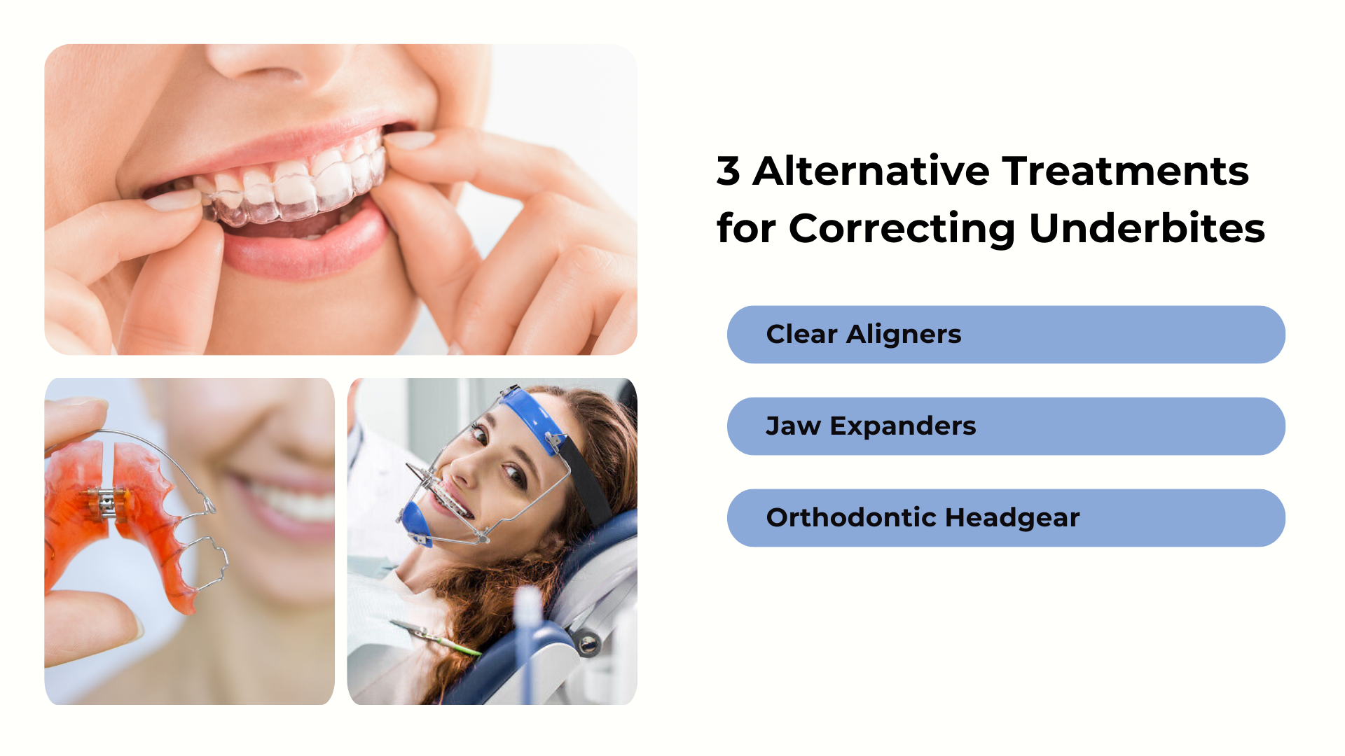 3 alternative treatments for correcting underbites