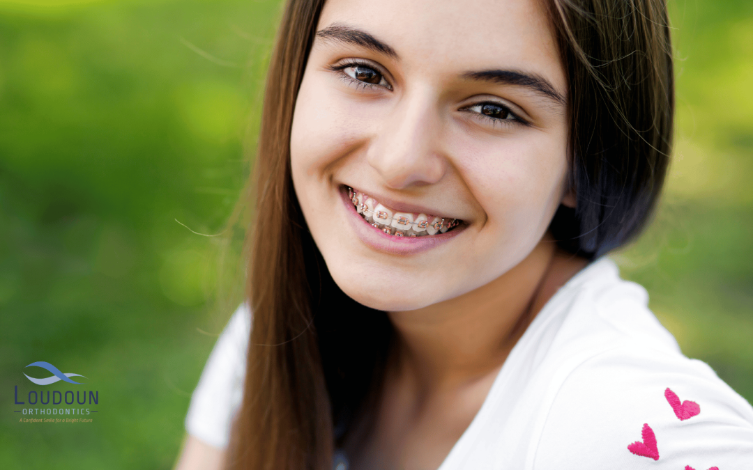 6 Tips for Managing Pain and Discomfort during Orthodontic Treatment