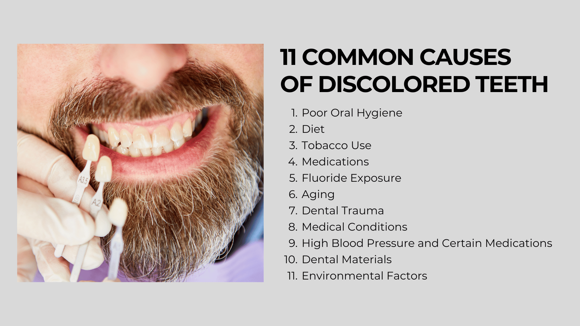 11 common causes of discolored teeth