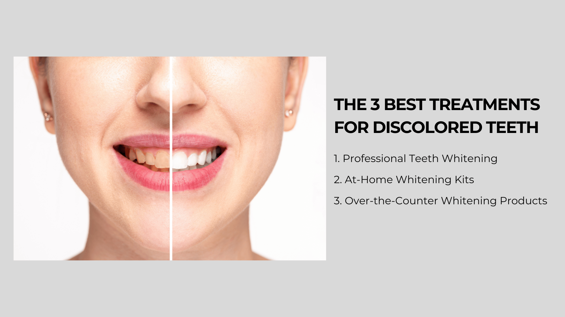 the 3 best treatments for discolored teeth