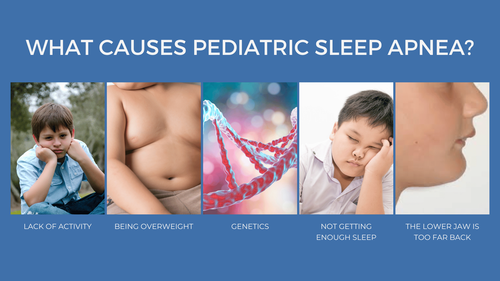 This is an infographic detailing the causes of pediatric sleep apnea