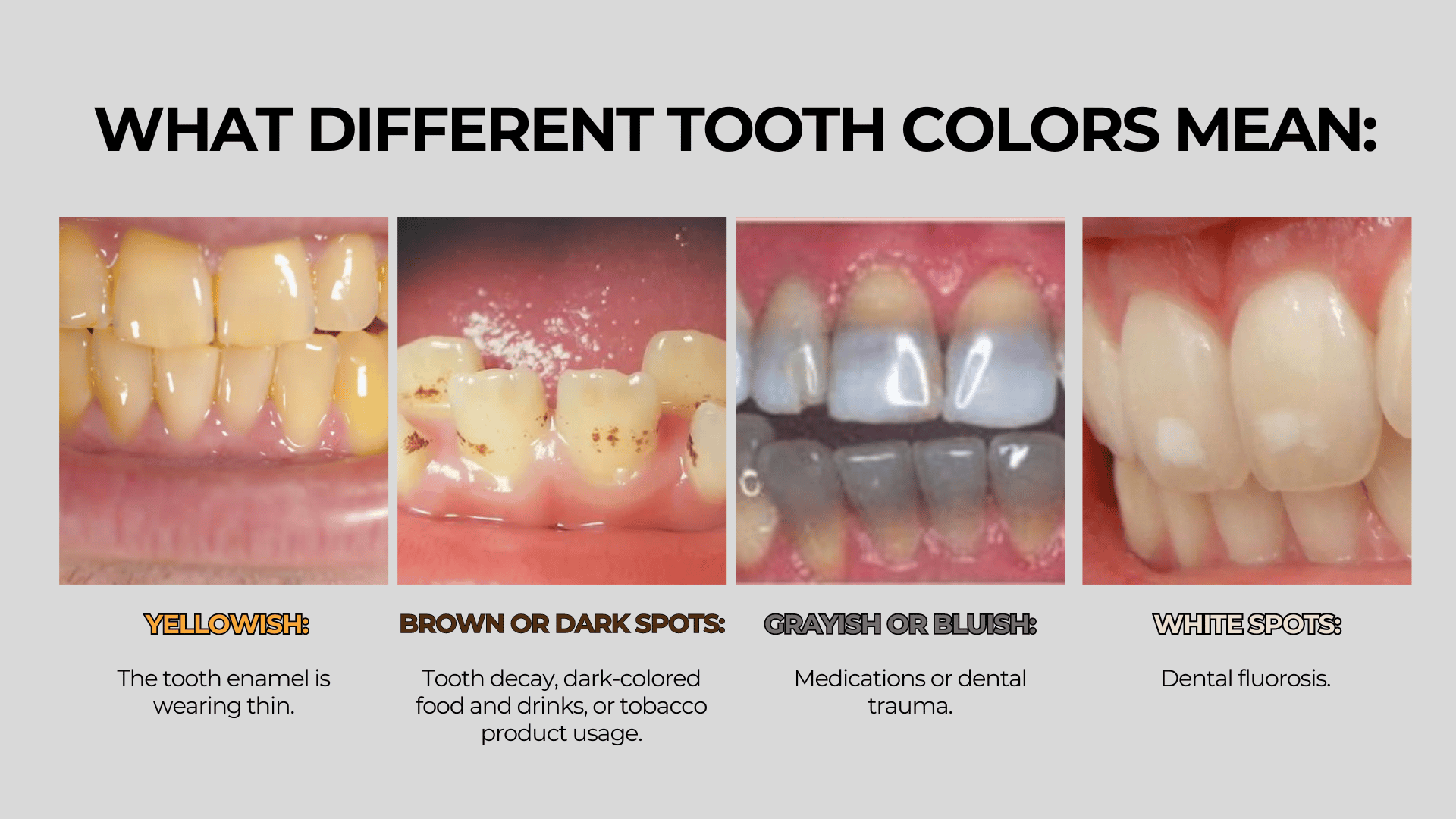 what different tooth colors mean