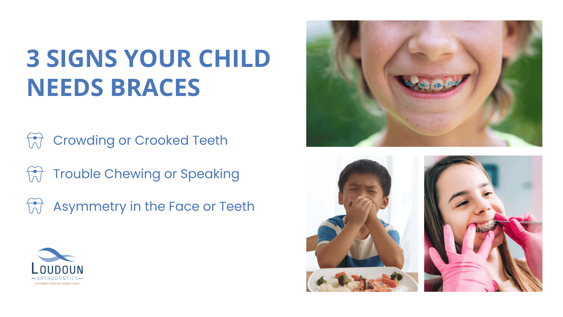 3 signs your child needs braces