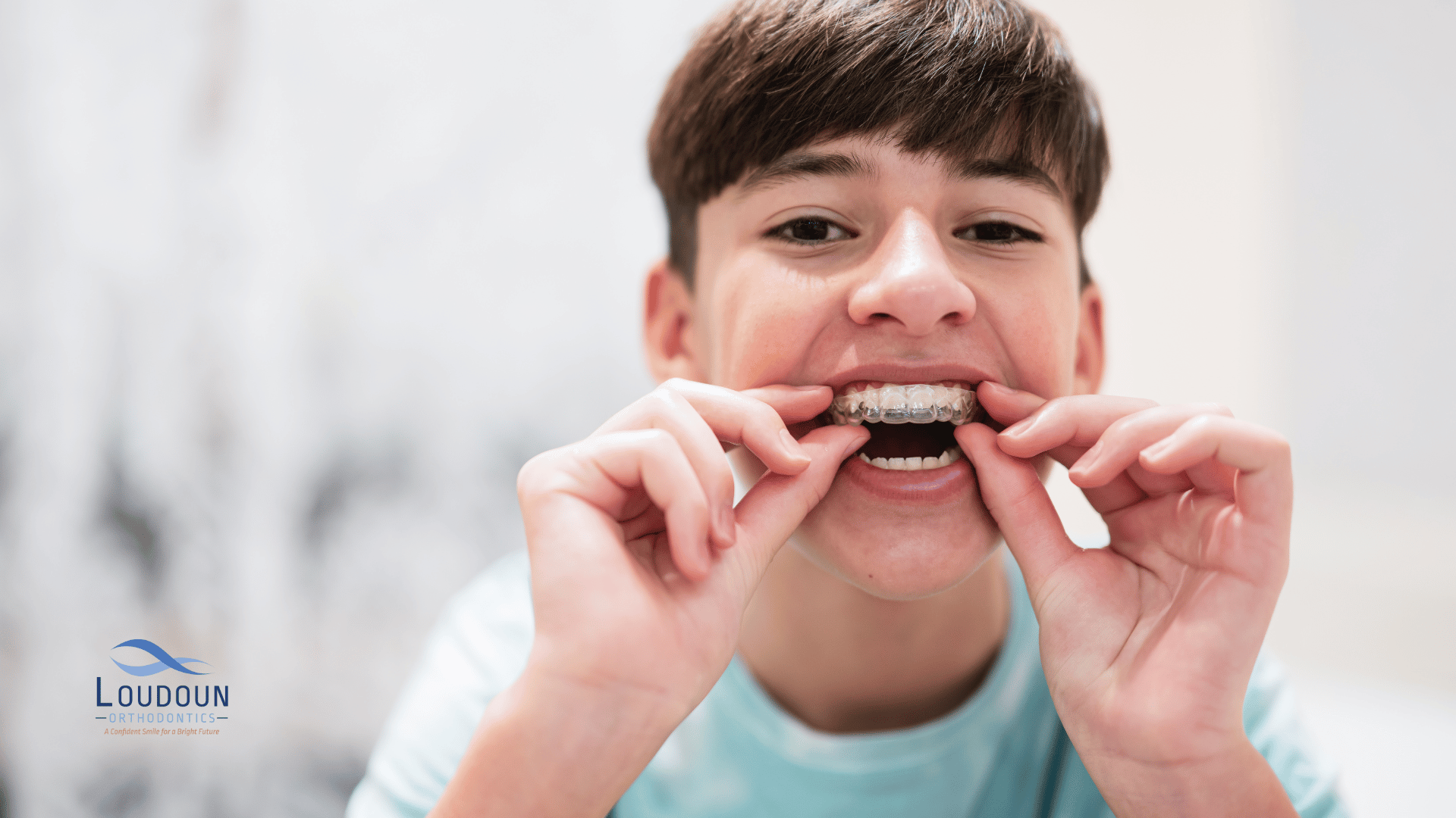 clear aligners for teens