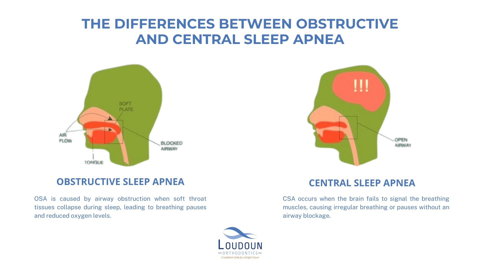 the differences between obstructive and central sleep apnea